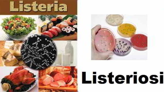 Surgelati ritirati da note aziende: rischio contaminazione Listeria.