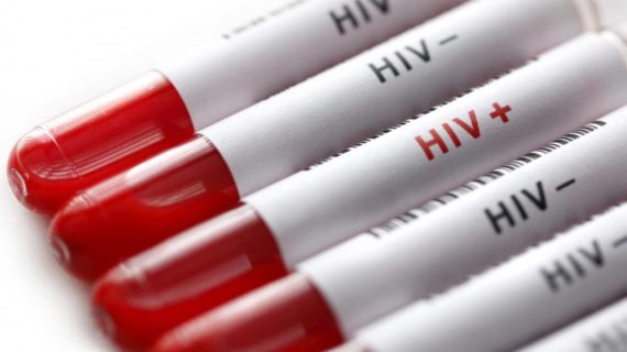 AIDS (HIV): ancora lunga da estirpare !