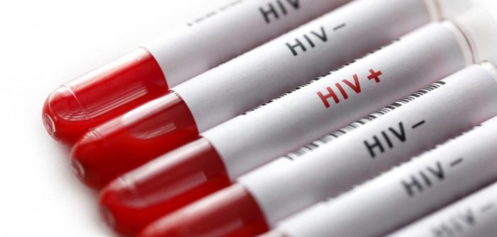 AIDS (HIV): ancora lunga da estirpare !